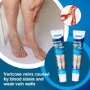 Varicream 3 em 1 - VARIZES, VASINHOS E INCHAÇOS!
