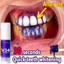 BrightSmile kit [V34]® - Clareamento Dental