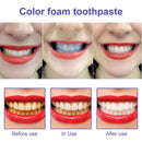 BrightSmile kit [V34]® - Clareamento Dental